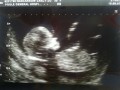 The baby scan... :)